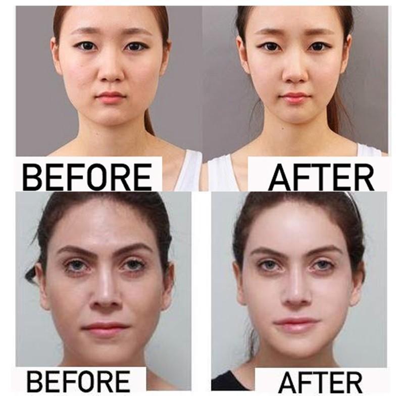 Miracle V-Shaped Slimming Mask (2PCS/SET) beachysalt