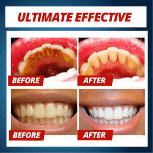 Intensive Stain Removal Whitening Toothpaste beachysalt 